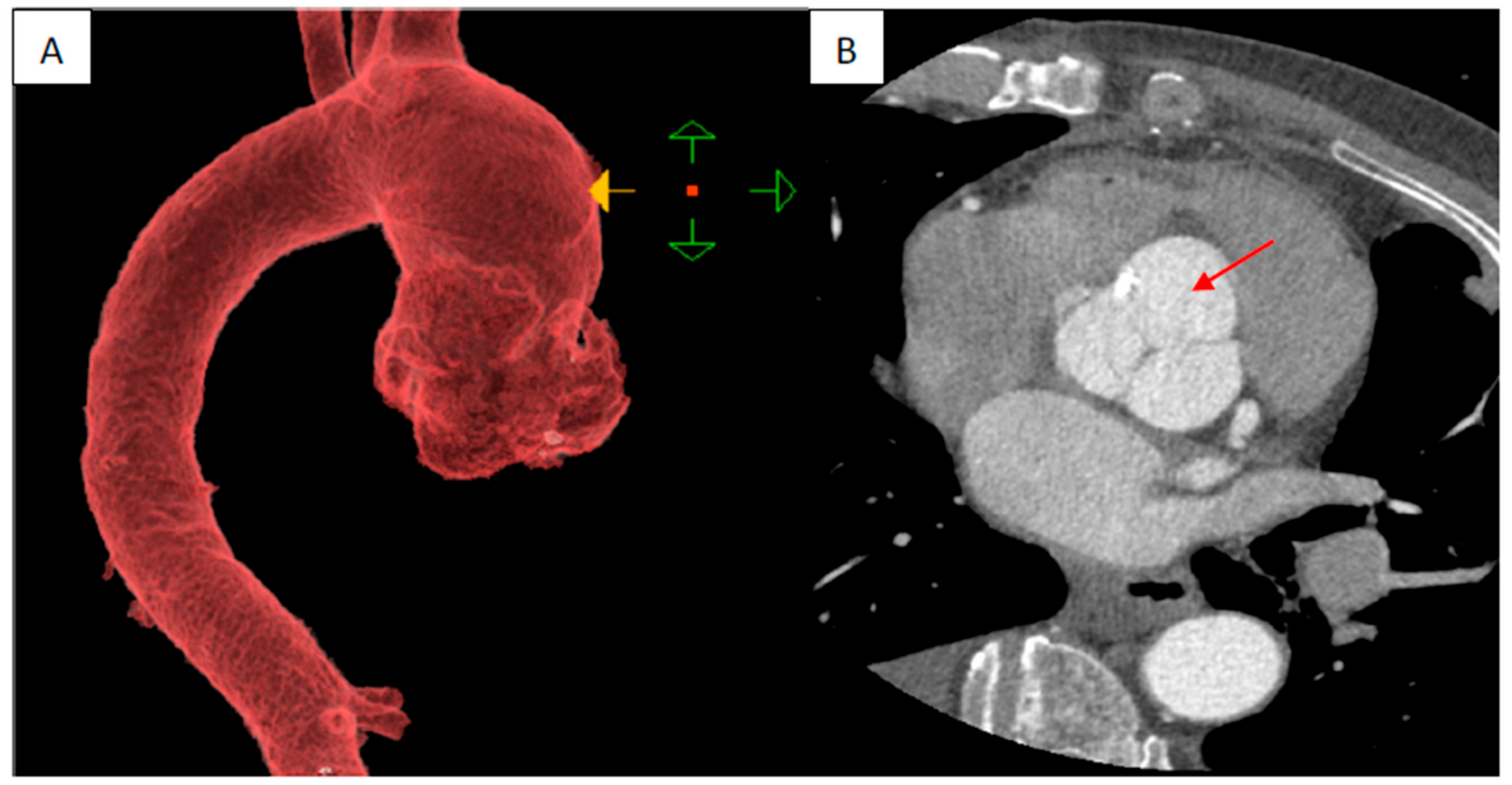 Jcm 13 02297 g002 Jcm 13 02297 g002