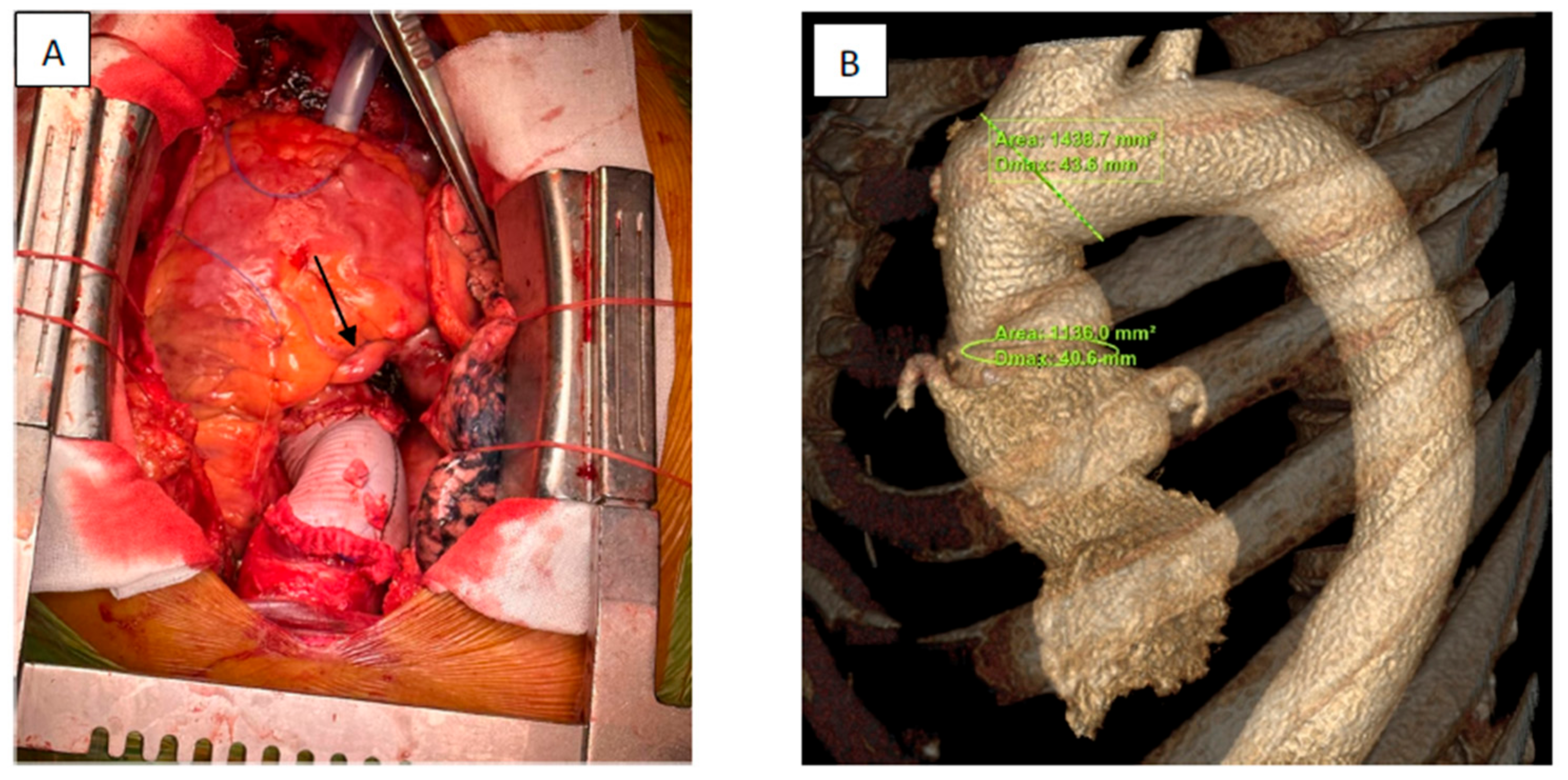 Jcm 13 02297 g006 Jcm 13 02297 g006