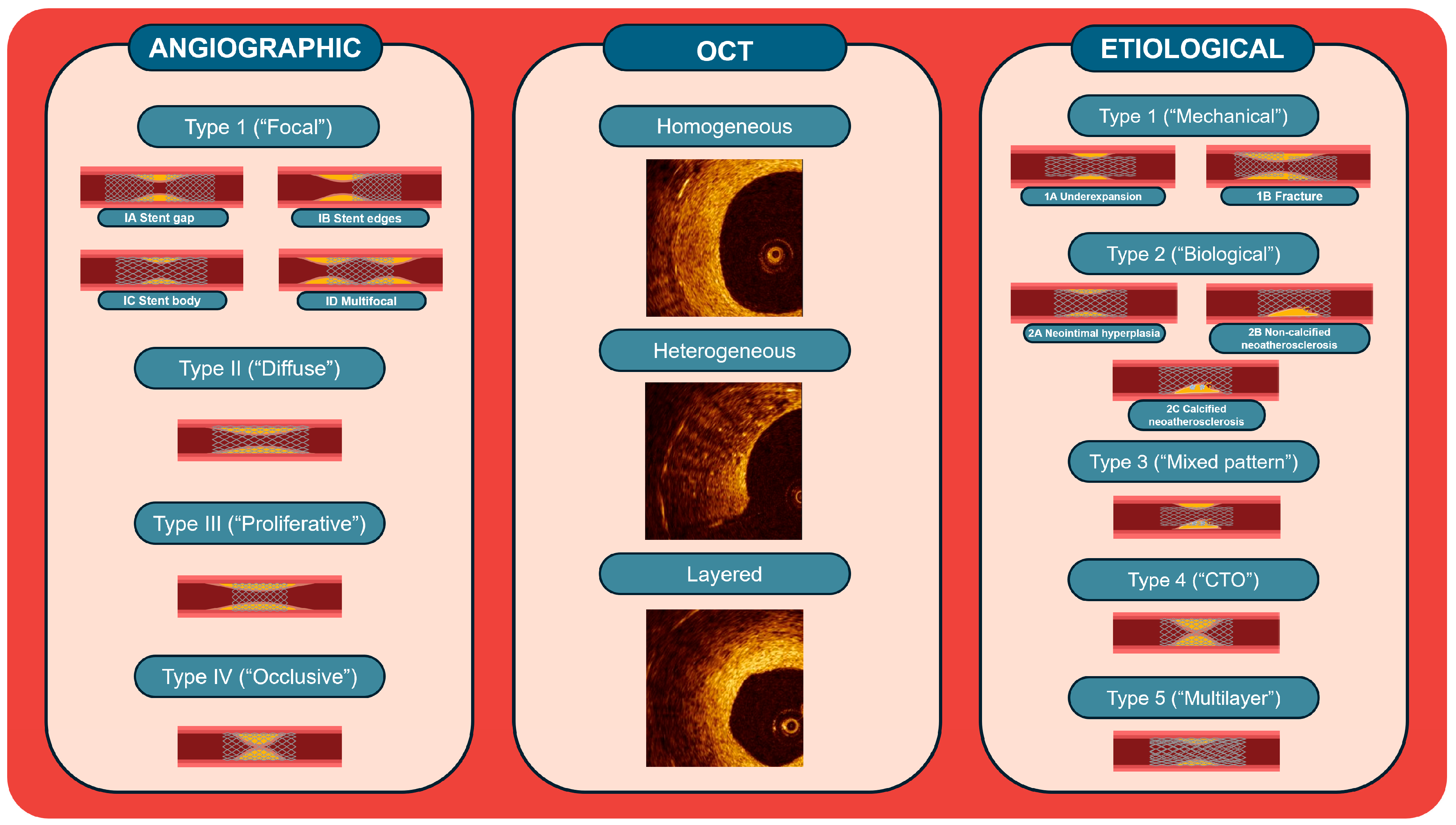 Jcm 13 02377 g001 Jcm 13 02377 g001