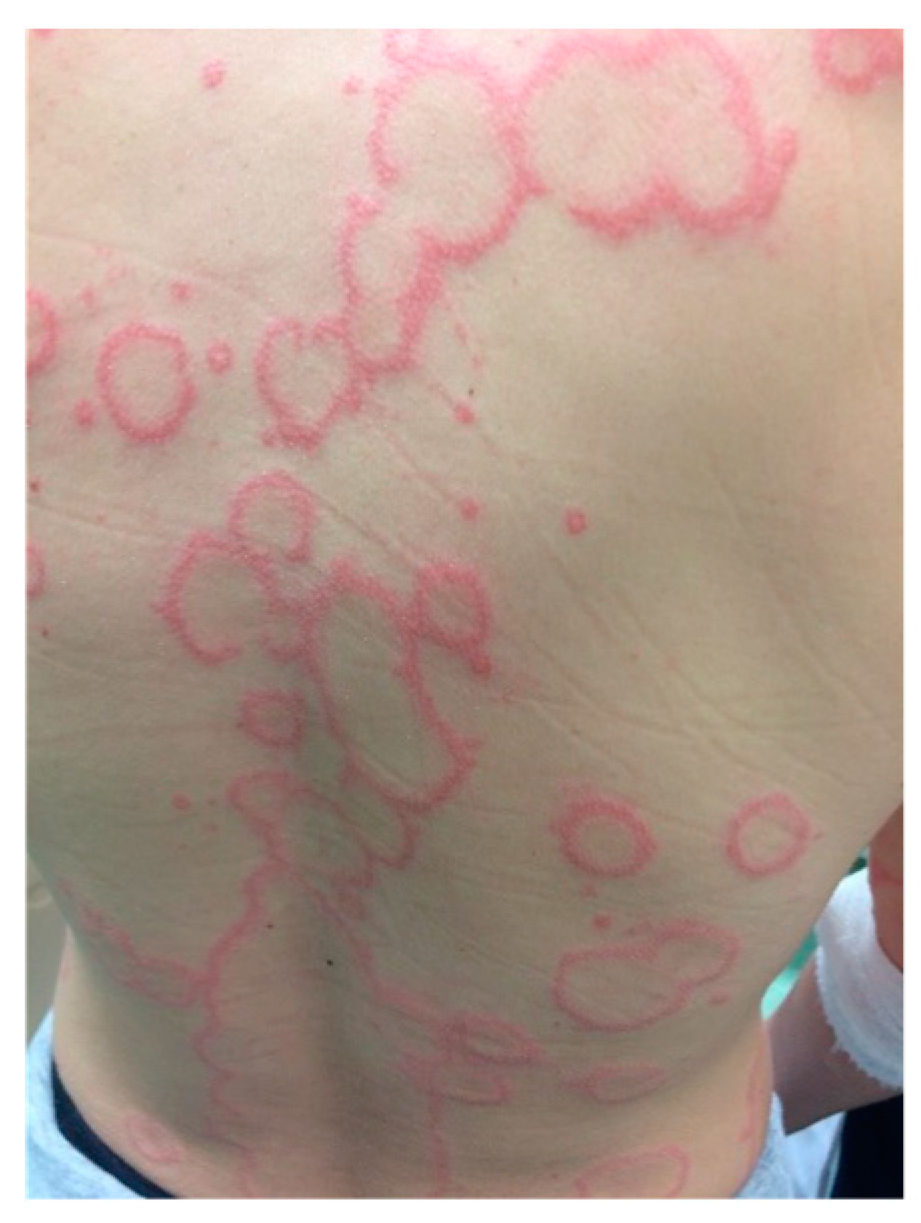 Jcm 13 02419 g004 Jcm 13 02419 g004