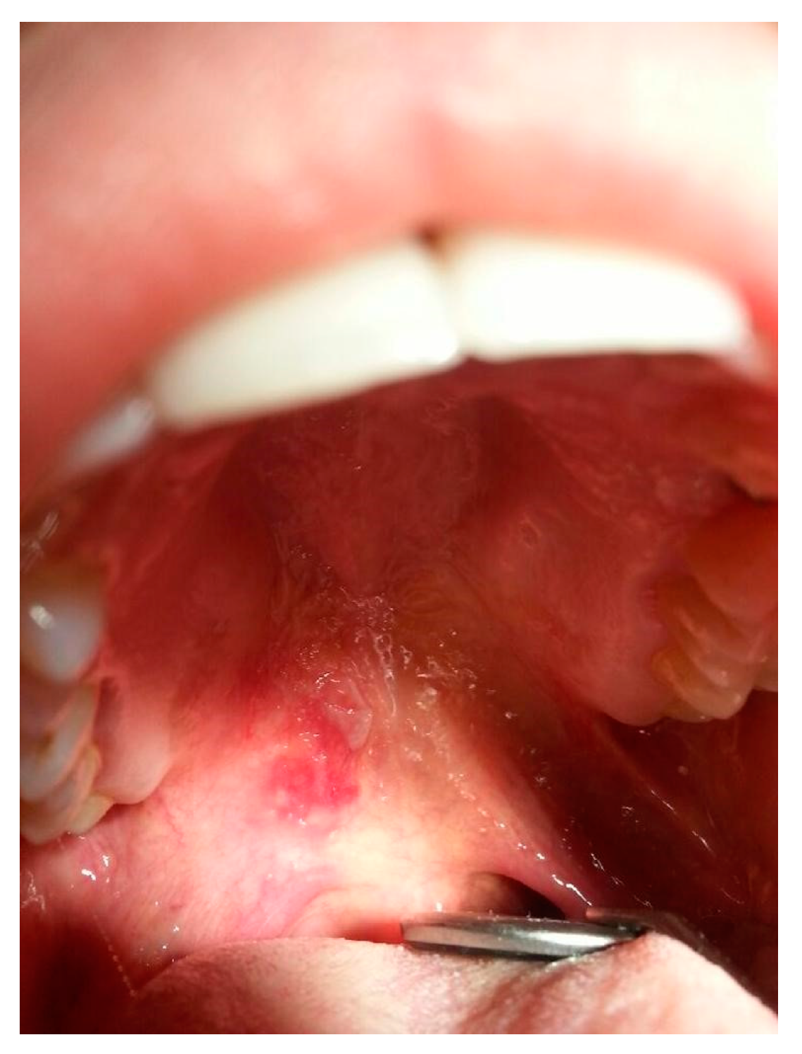 Jcm 13 02419 g009 Jcm 13 02419 g009