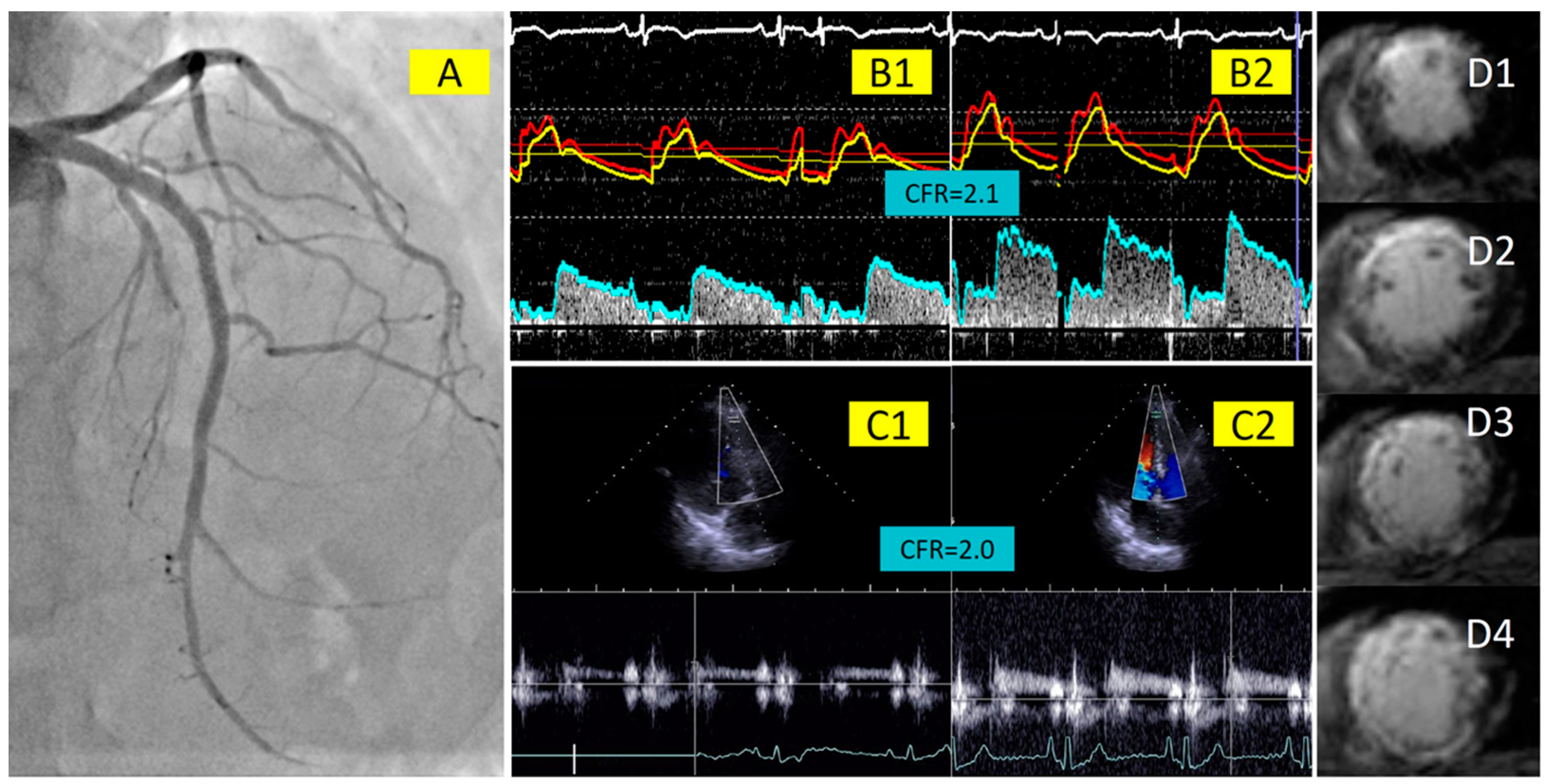 Jcm 13 02484 g006 Jcm 13 02484 g006