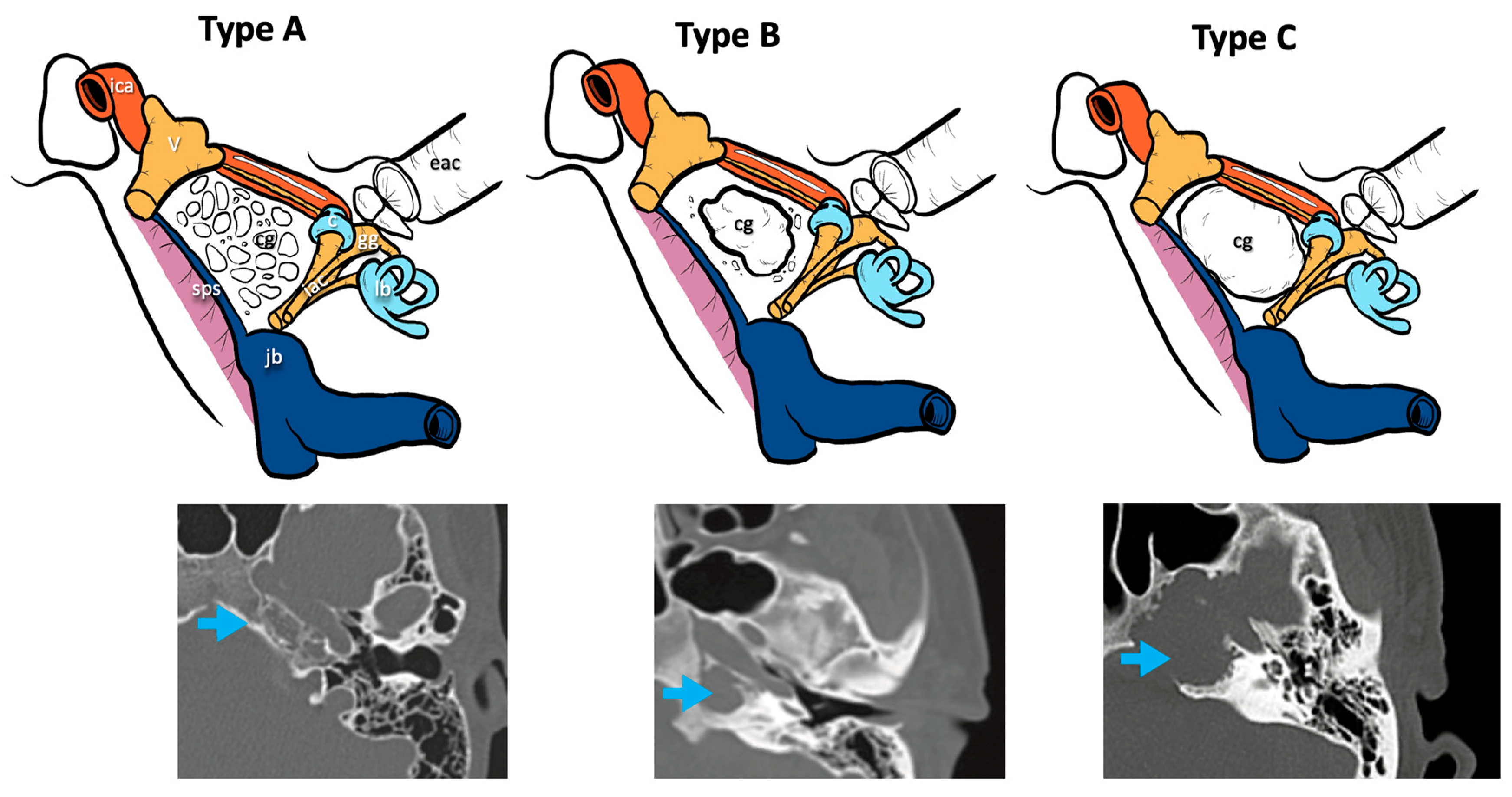Radiological Classification and Management Algorithm of