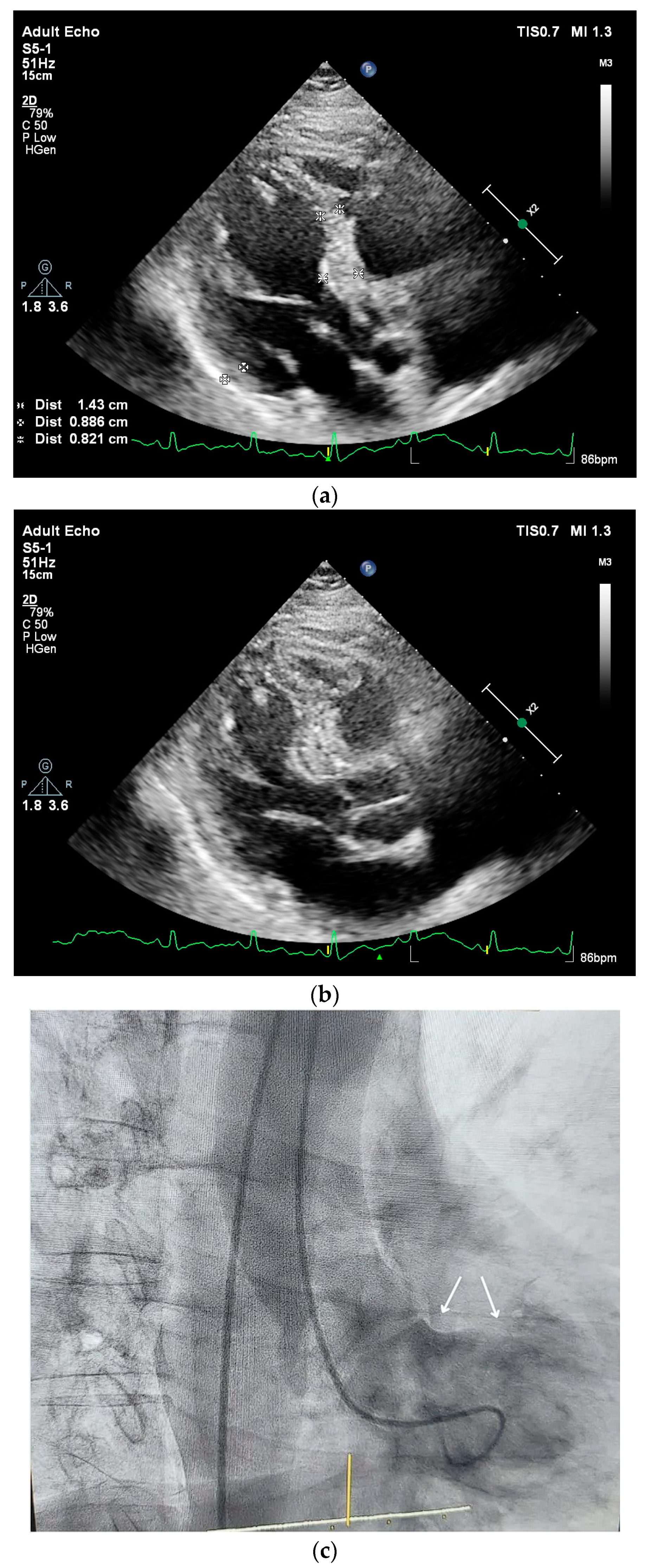 Jcm 13 02597 g003 Jcm 13 02597 g003