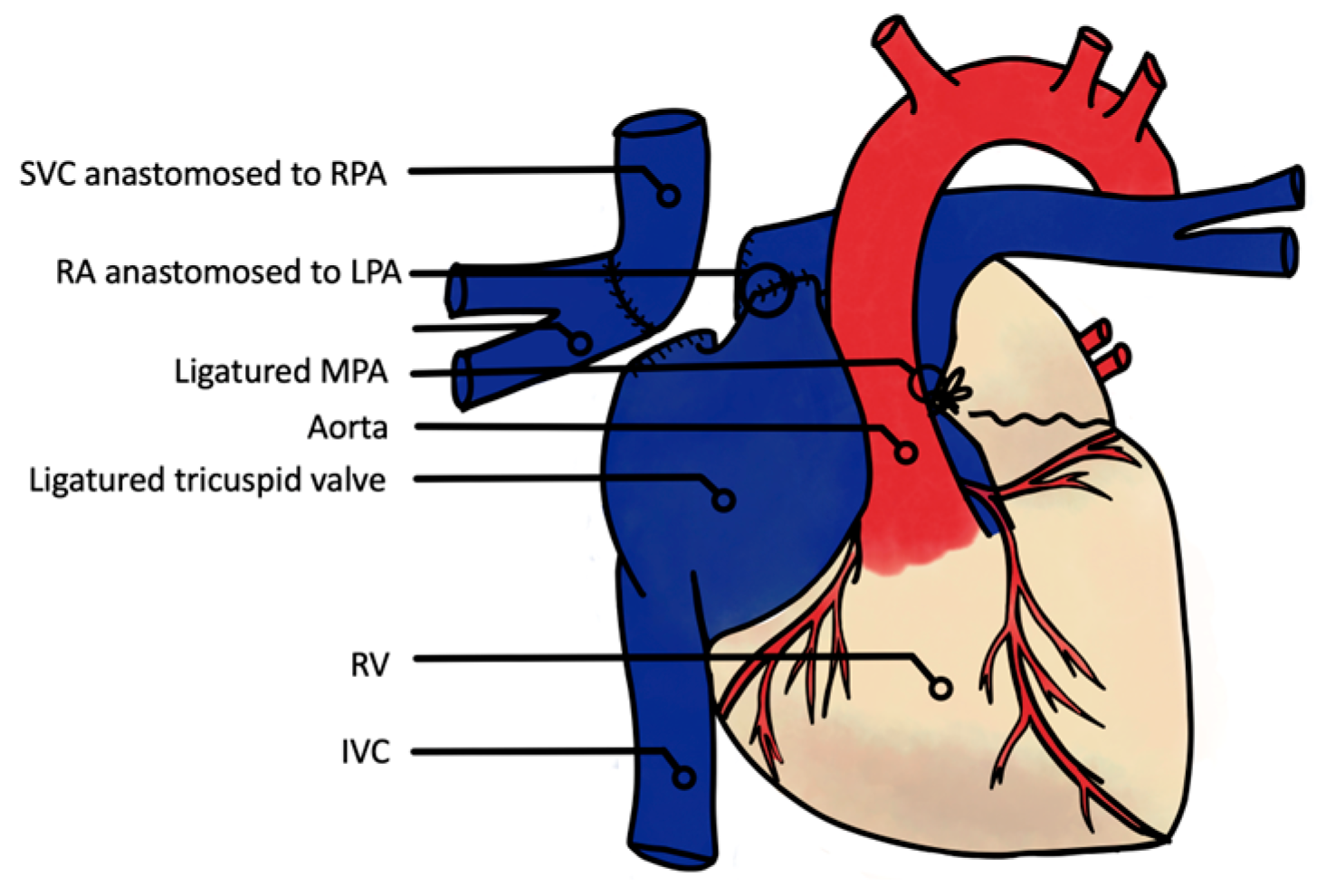 Jcm 13 02601 g001 Jcm 13 02601 g001