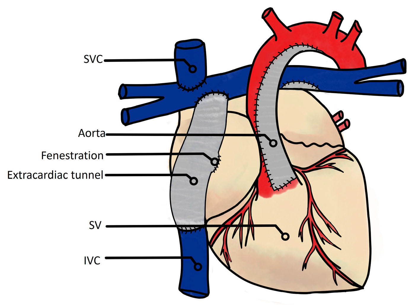 Jcm 13 02601 g002 Jcm 13 02601 g002