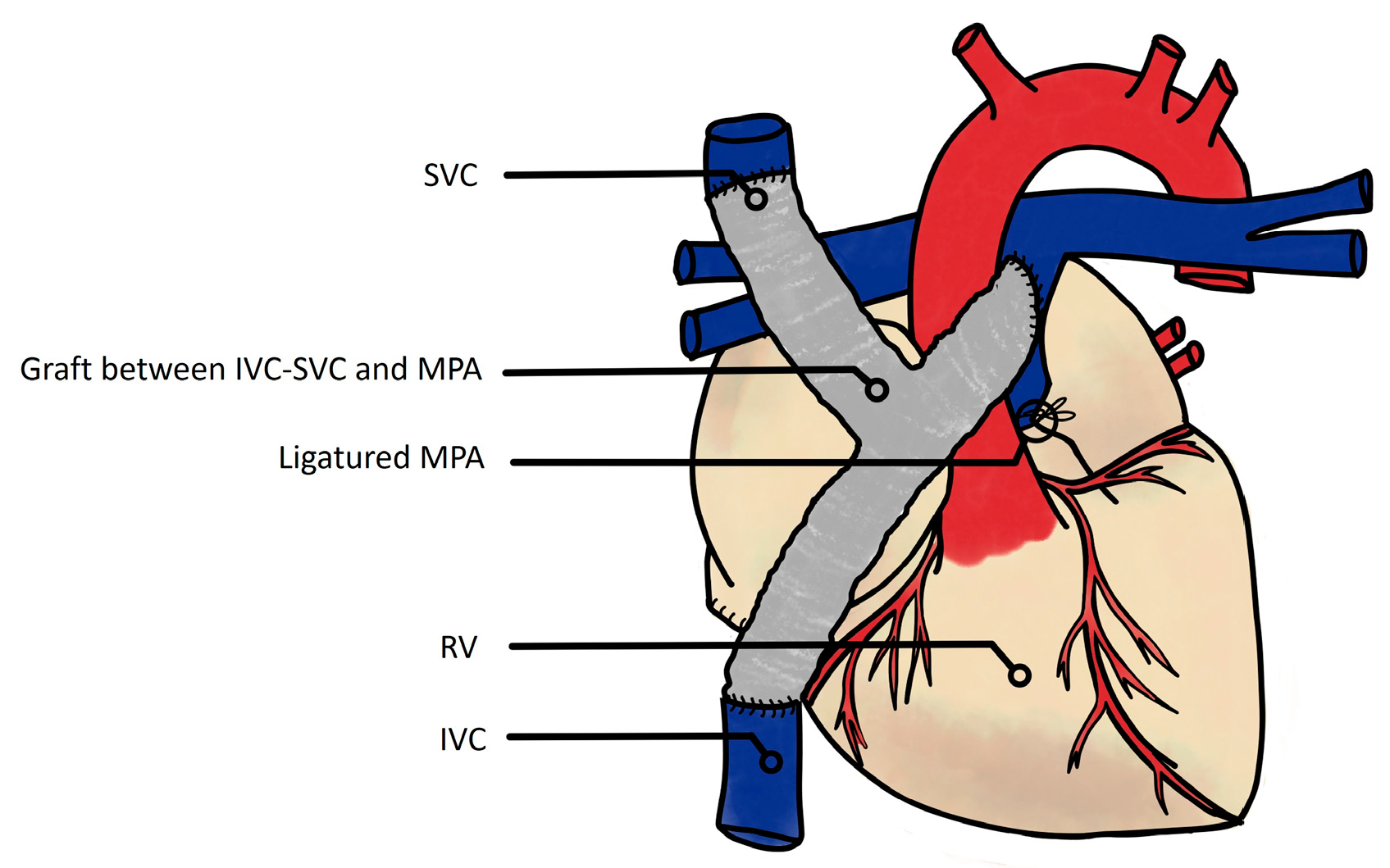 Jcm 13 02601 g003 Jcm 13 02601 g003