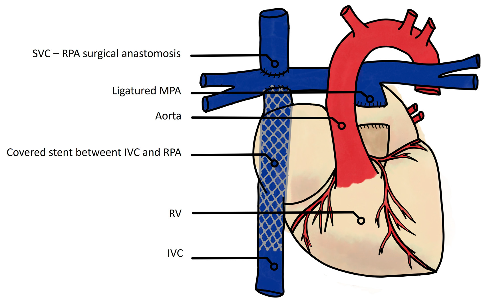 Jcm 13 02601 g004 Jcm 13 02601 g004