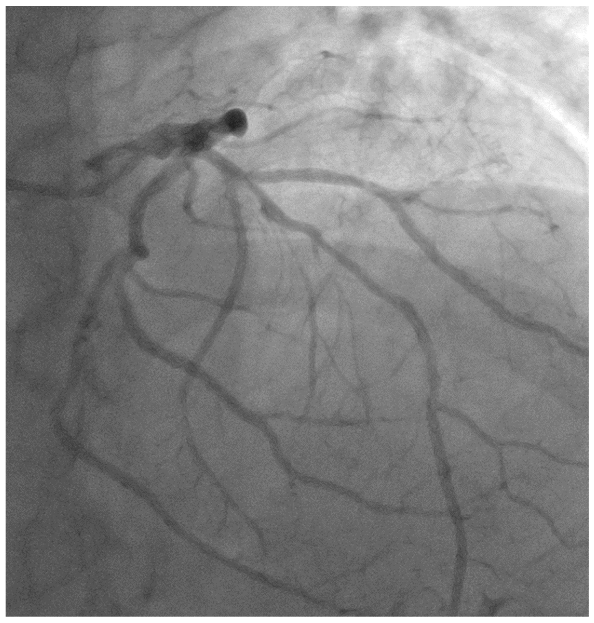 Jcm 13 02645 g002 Jcm 13 02645 g002