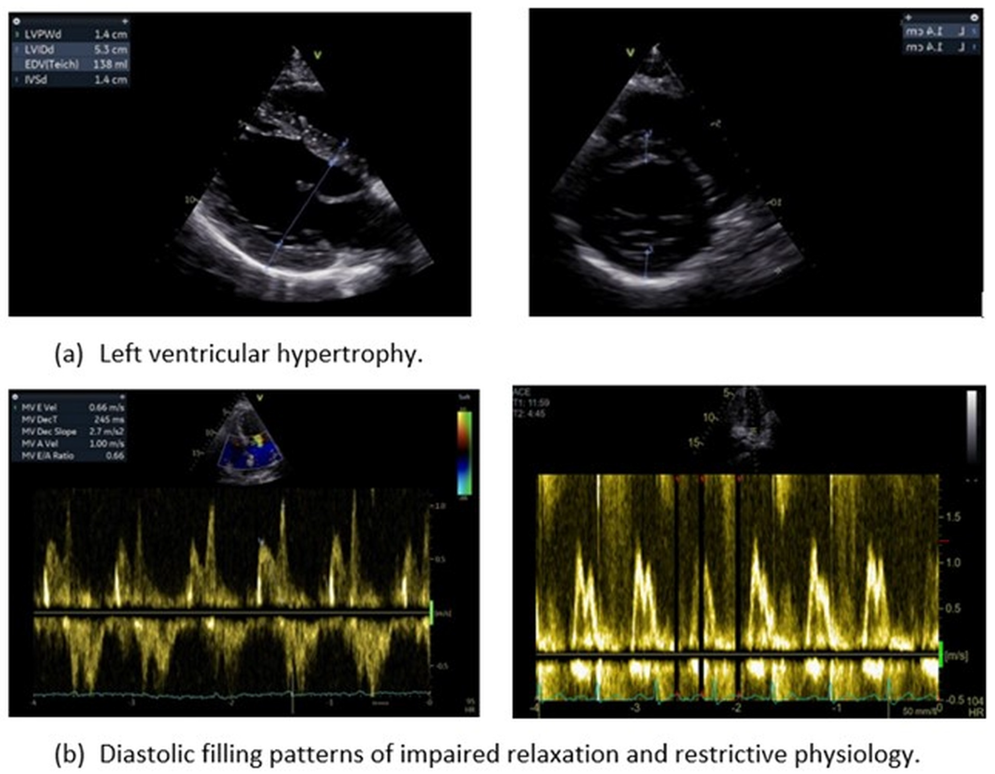 Jcm 13 02708 g002 Jcm 13 02708 g002
