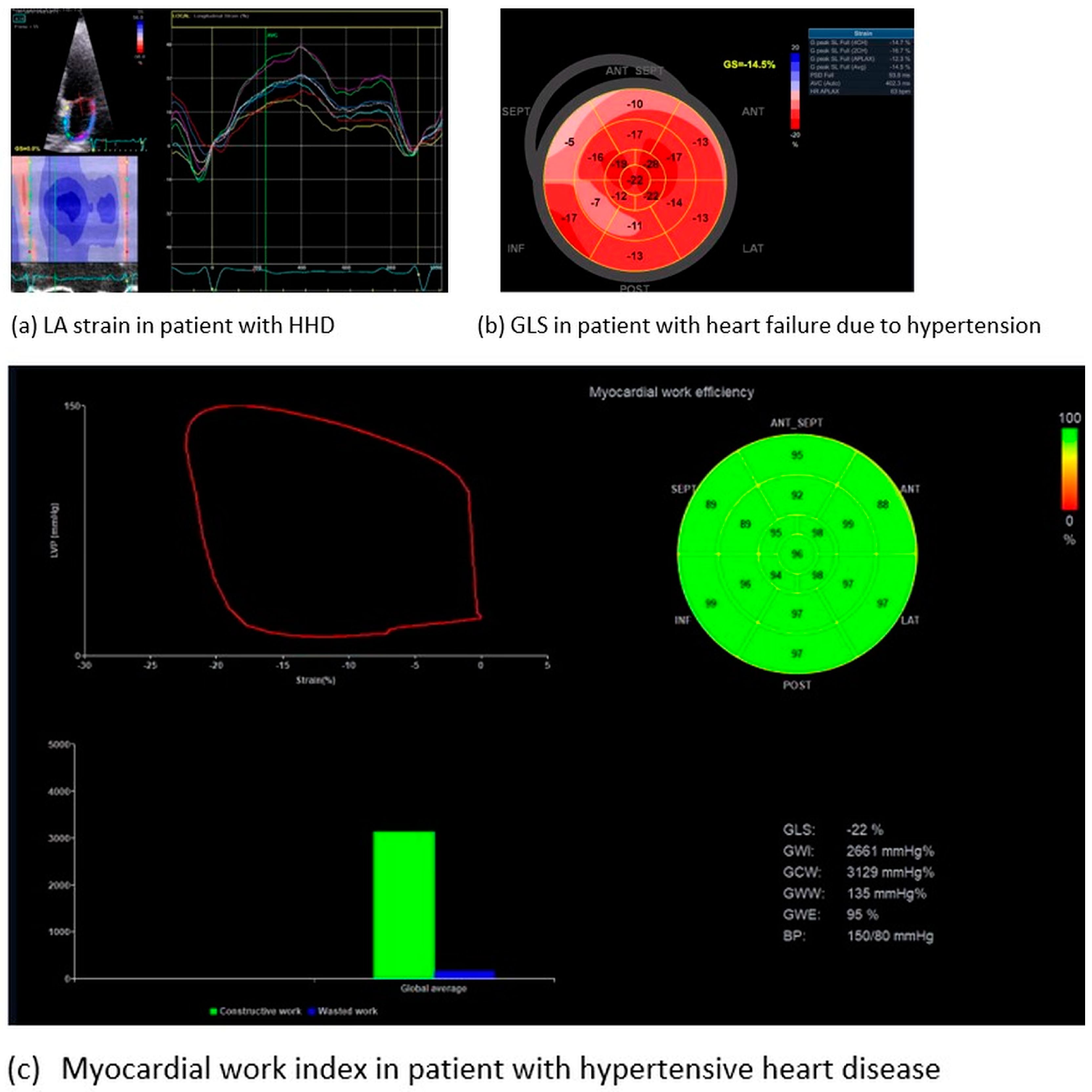 Jcm 13 02708 g003 Jcm 13 02708 g003