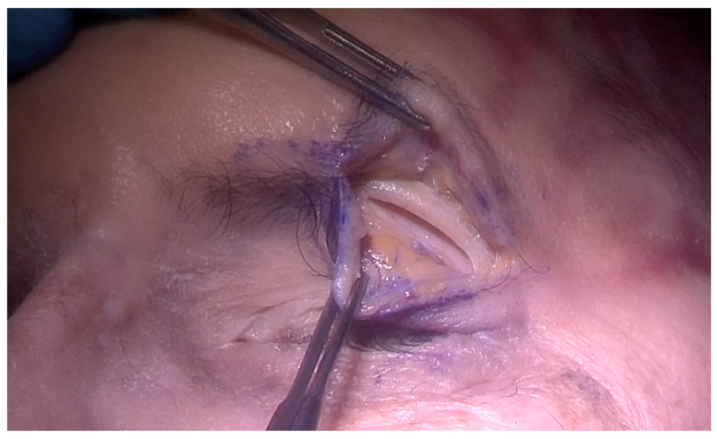 Jcm 13 02712 g001 Jcm 13 02712 g001