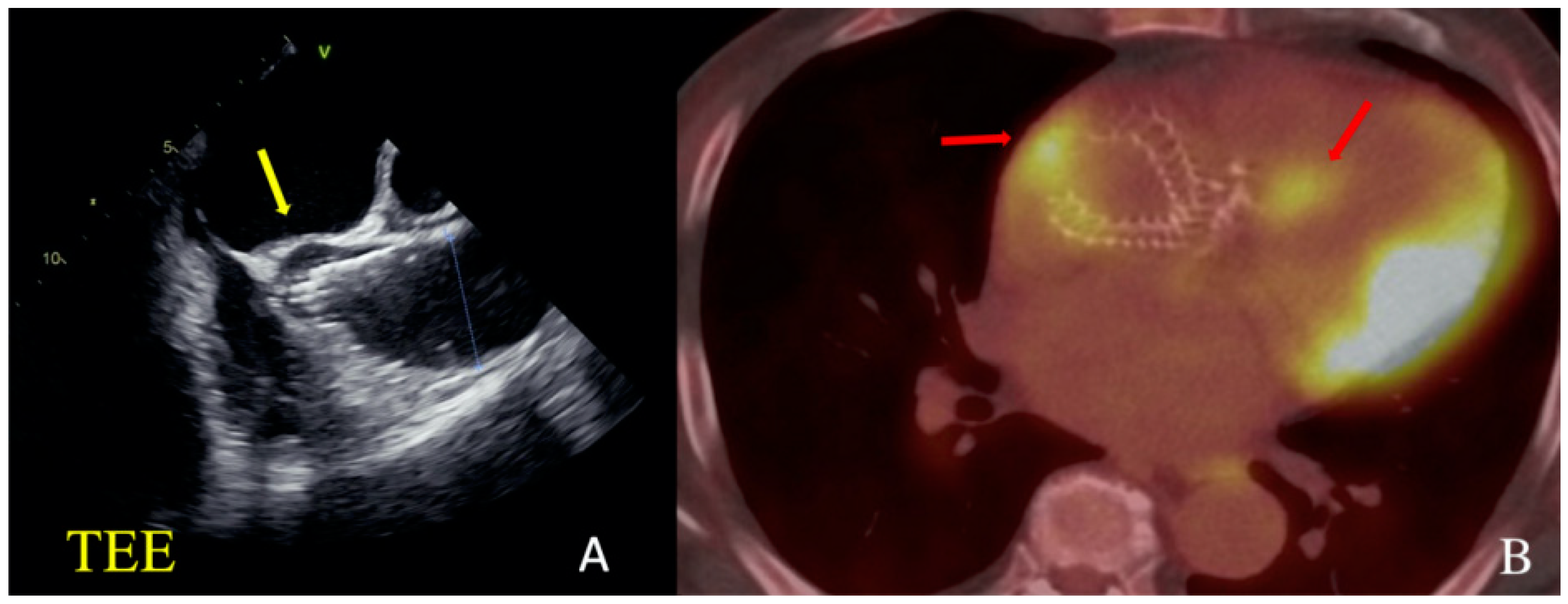 Jcm 13 02716 g002 Jcm 13 02716 g002