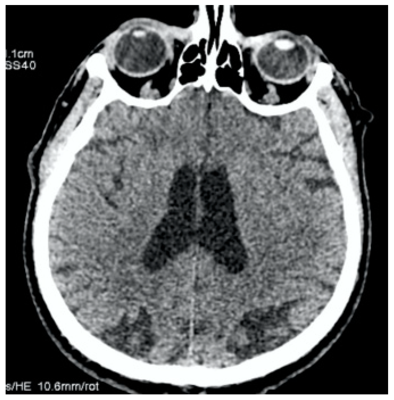Jcm 13 02716 g003 Jcm 13 02716 g003