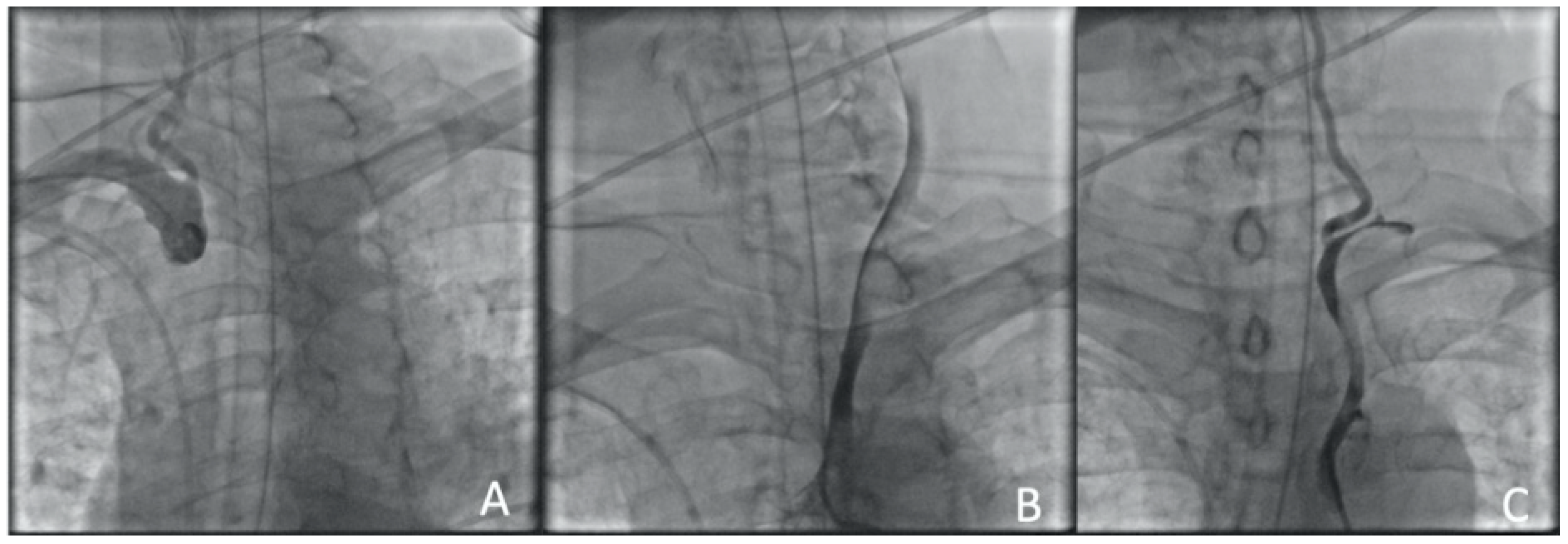 Jcm 13 02716 g004 Jcm 13 02716 g004