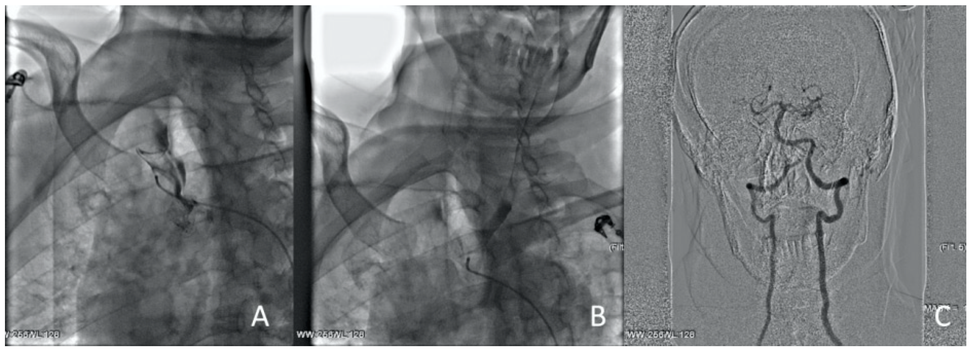 Jcm 13 02716 g010 Jcm 13 02716 g010