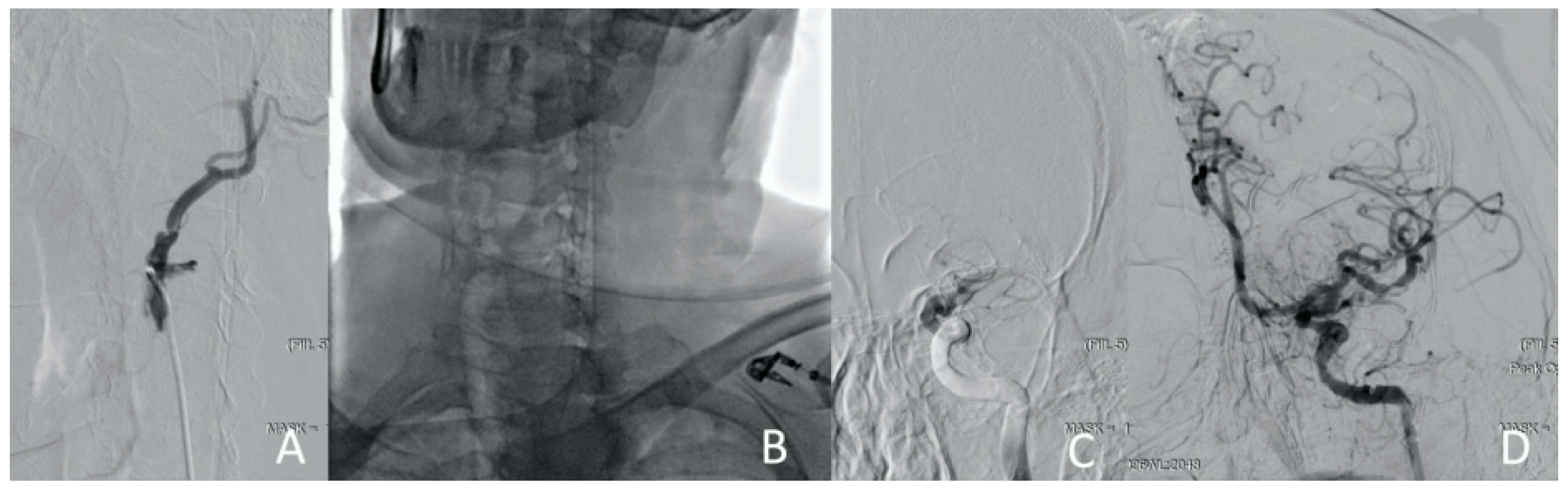 Jcm 13 02716 g011 Jcm 13 02716 g011