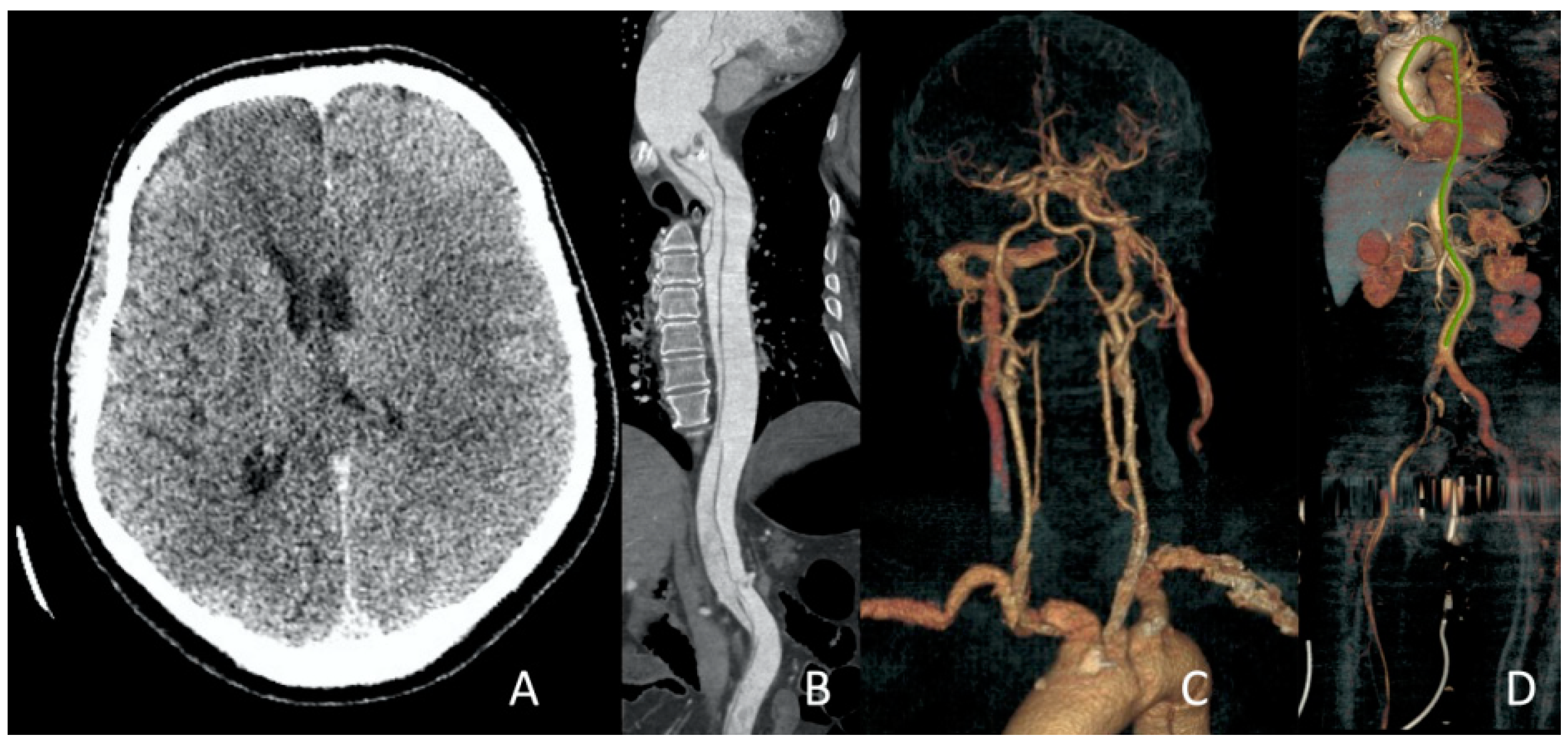 Jcm 13 02716 g014 Jcm 13 02716 g014