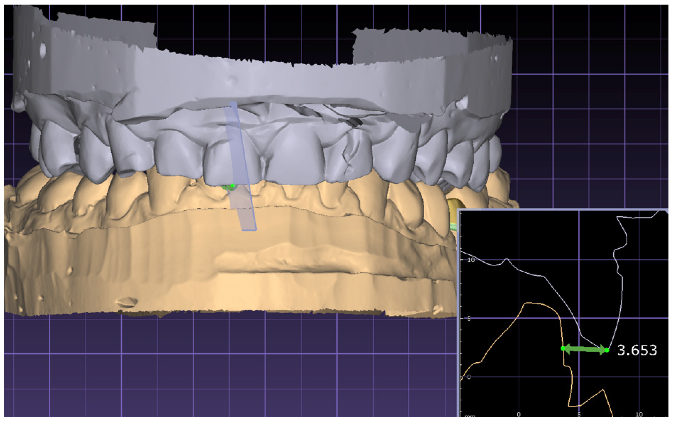 Jcm 13 02750 g002 Jcm 13 02750 g002
