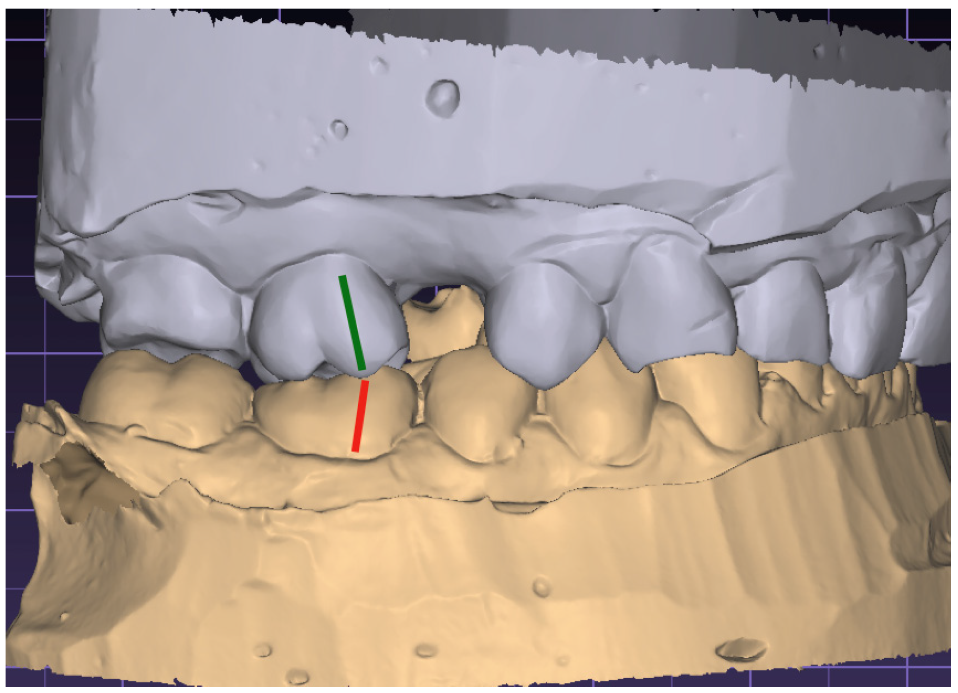 Jcm 13 02750 g004 Jcm 13 02750 g004