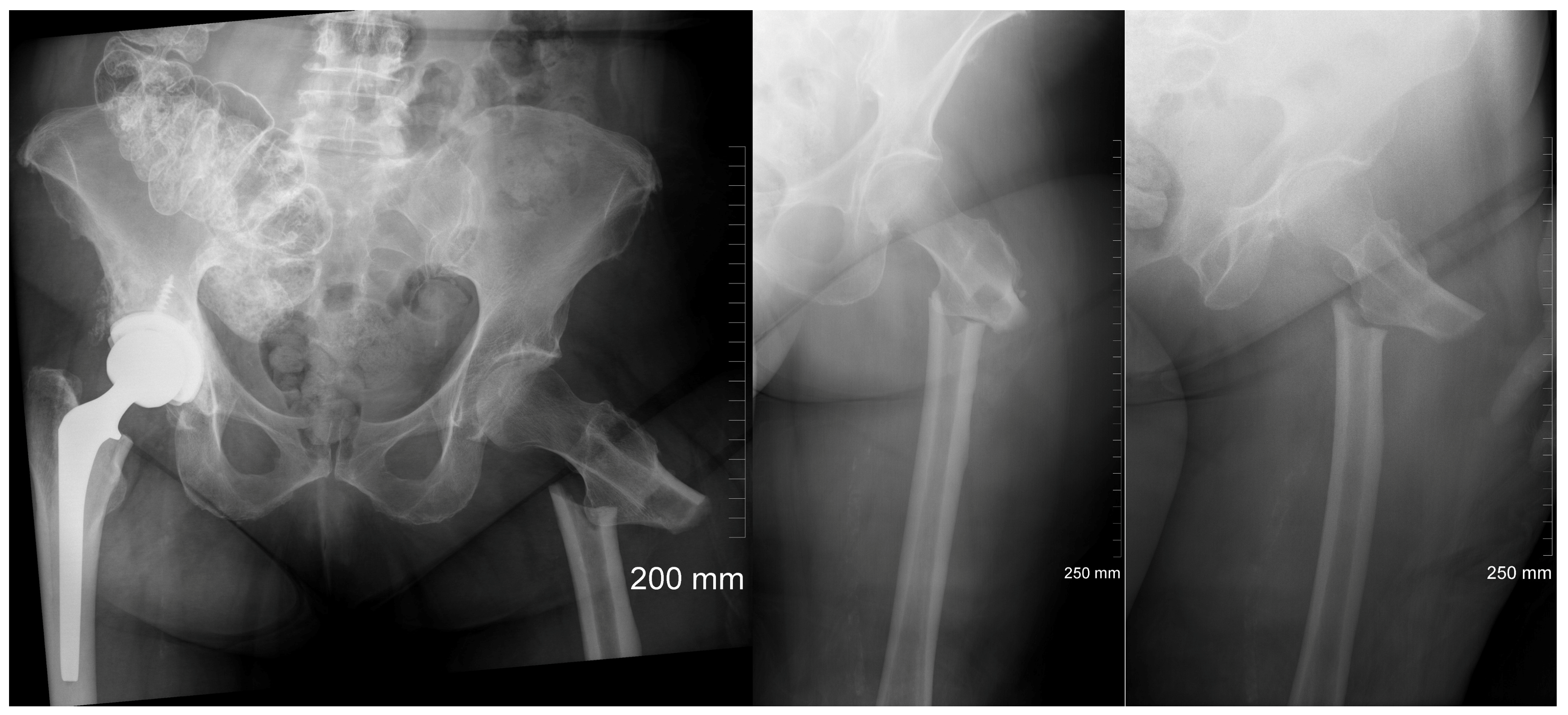 Jcm 13 02785 g001 Jcm 13 02785 g001