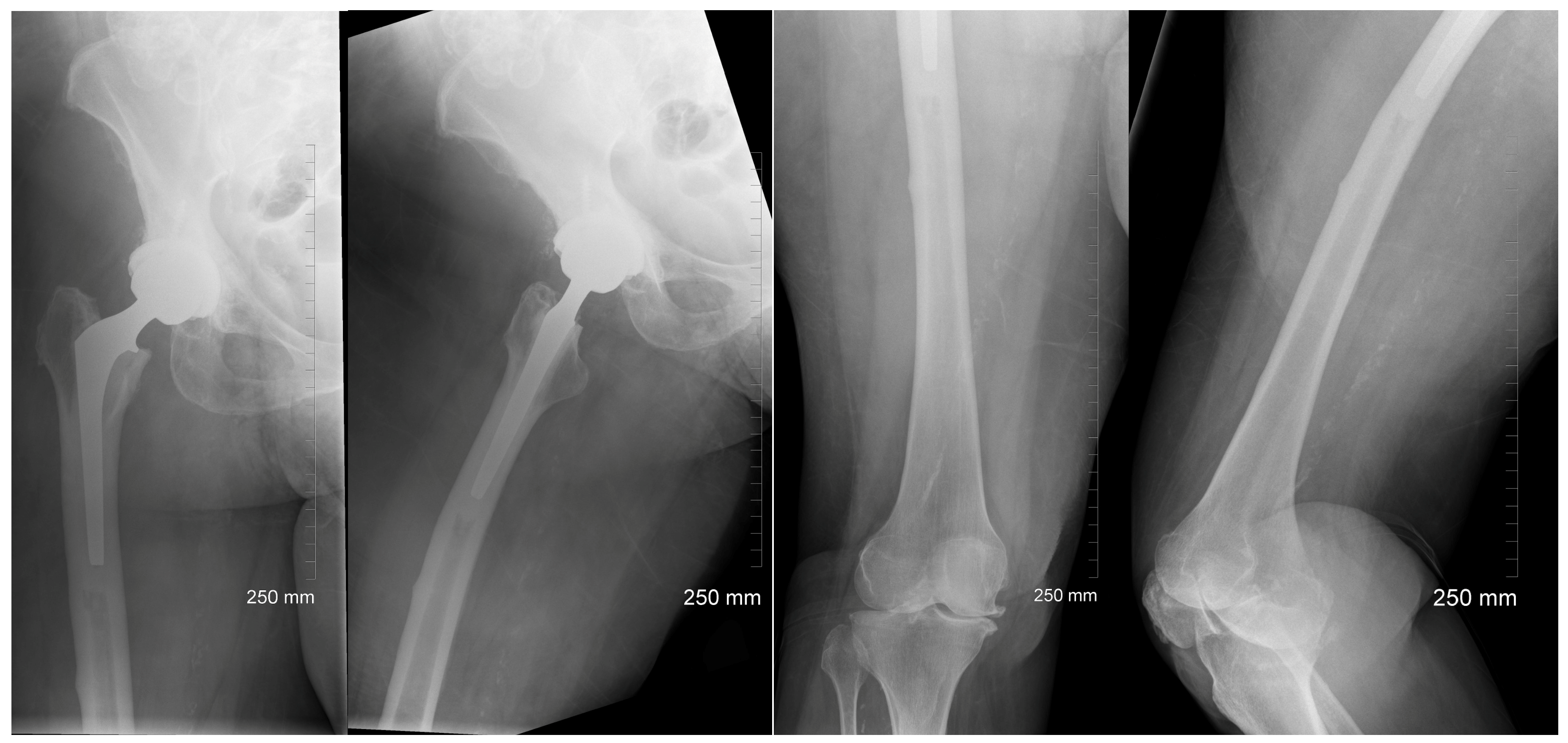 Jcm 13 02785 g002 Jcm 13 02785 g002