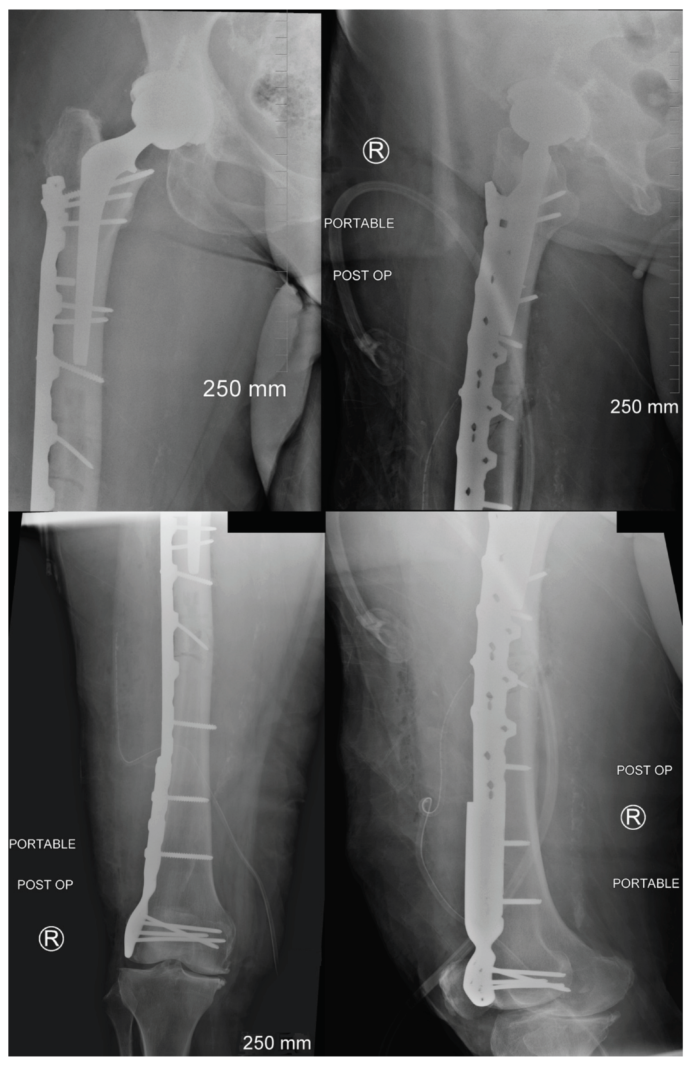 Jcm 13 02785 g005 Jcm 13 02785 g005
