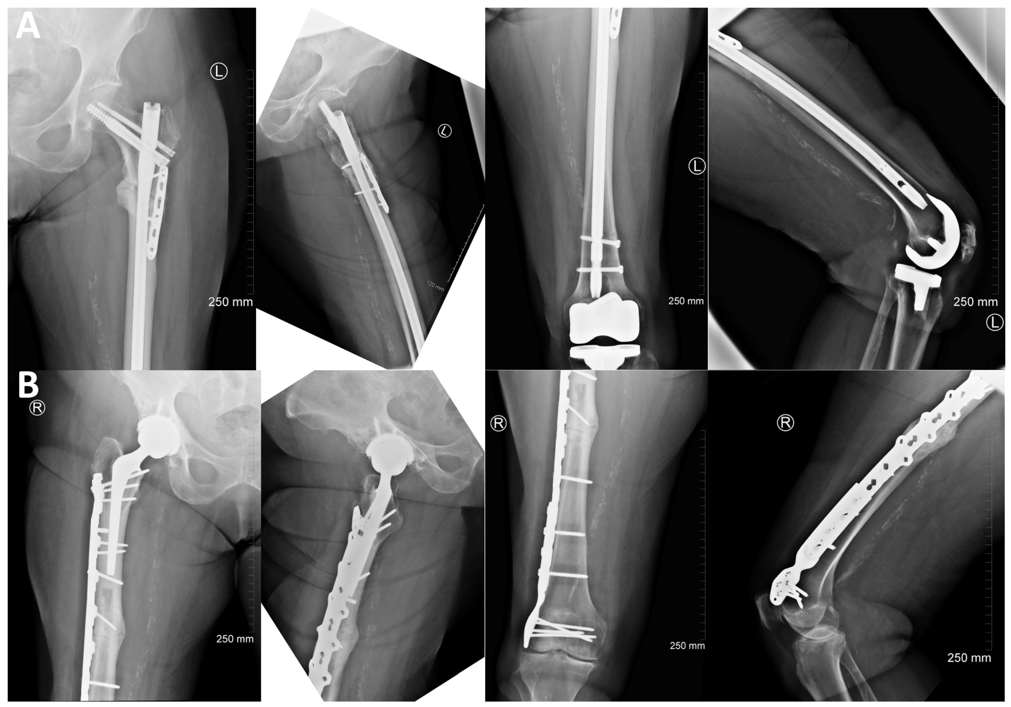 Jcm 13 02785 g006 Jcm 13 02785 g006