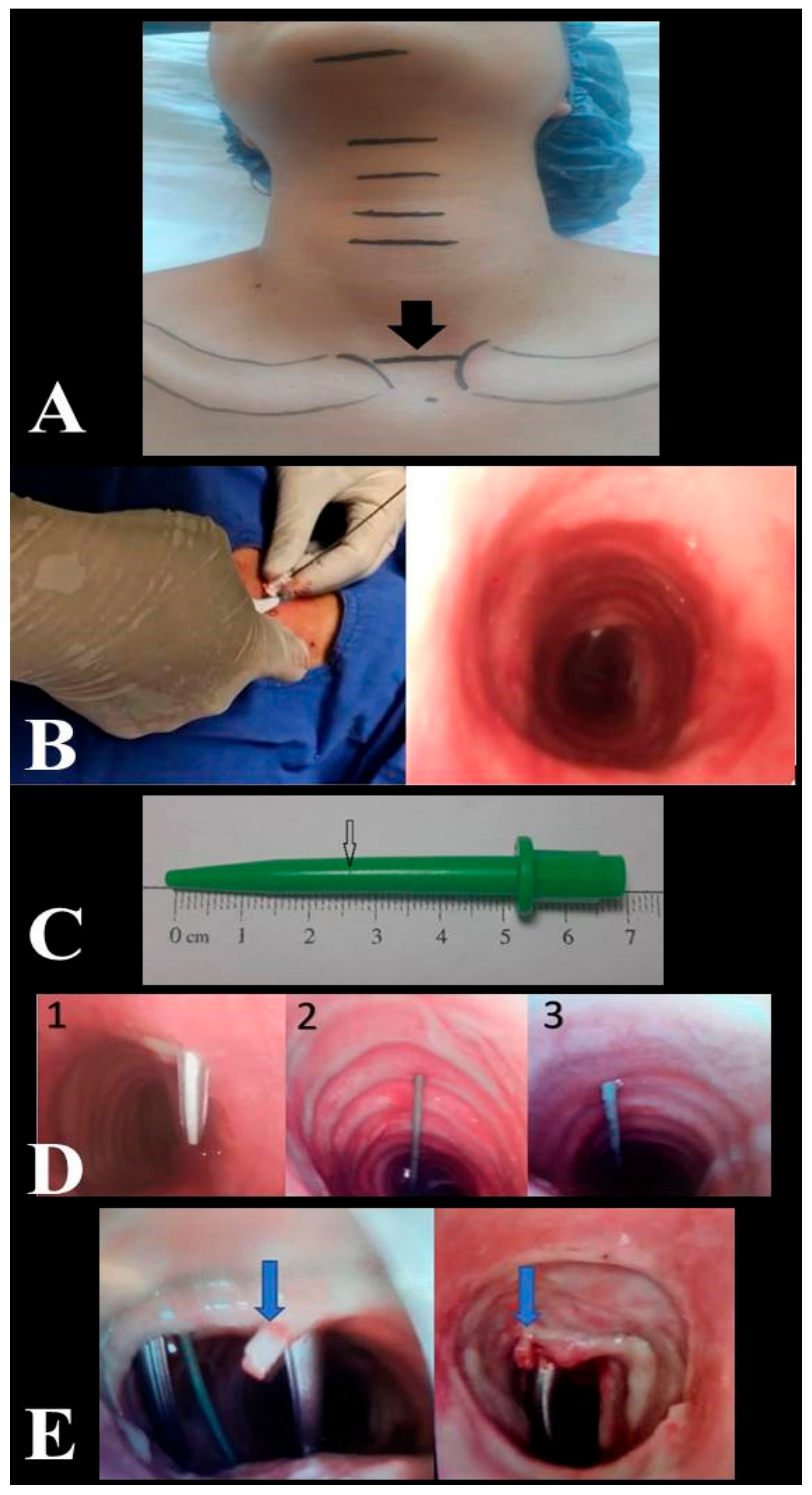 Jcm 13 02788 g001 Jcm 13 02788 g001