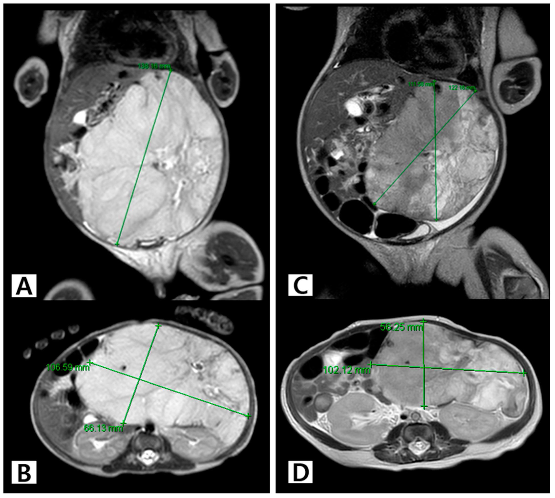 フィギュア27点 SIC風_10号誕生！仮面ライダーZX | オーメン72 （移転）