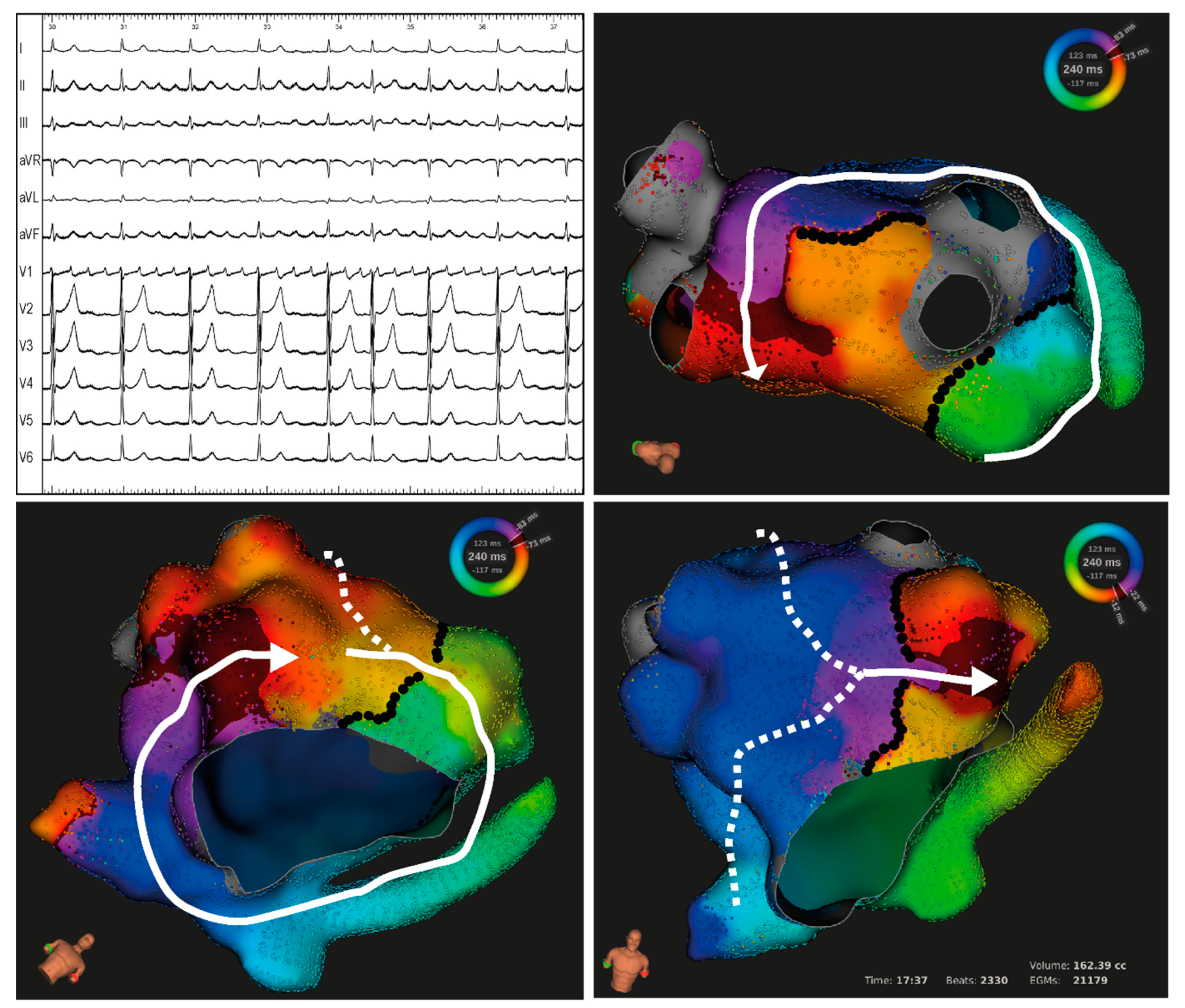 Jcm 13 02847 g004 Jcm 13 02847 g004