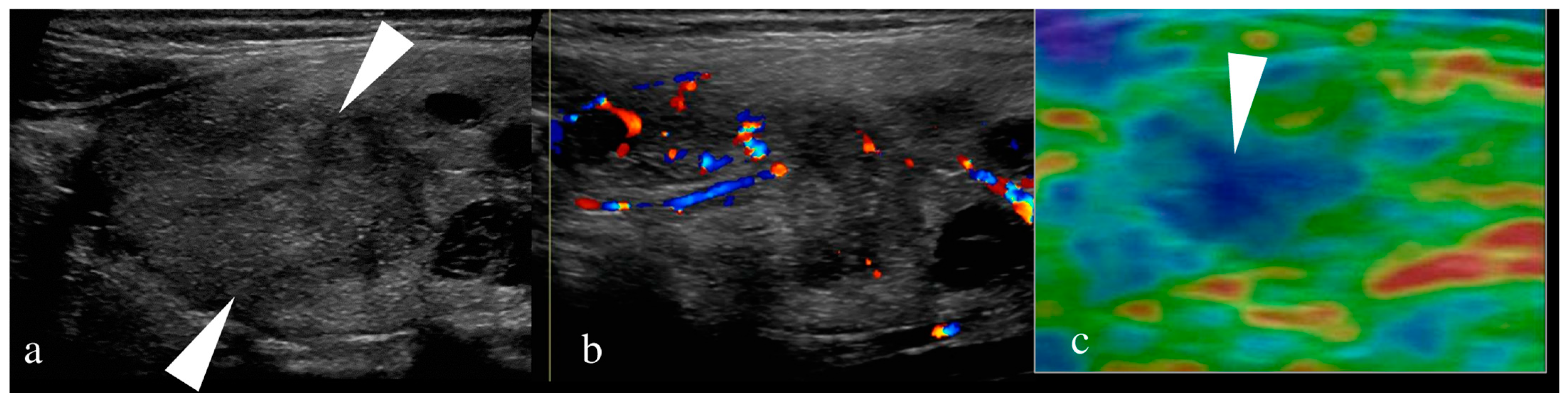 Thyroid Cancer Explore vol.3 no.2(2201 「Thyroid Cancer Expl Comprehensive Review of the Imaging Recommendations for