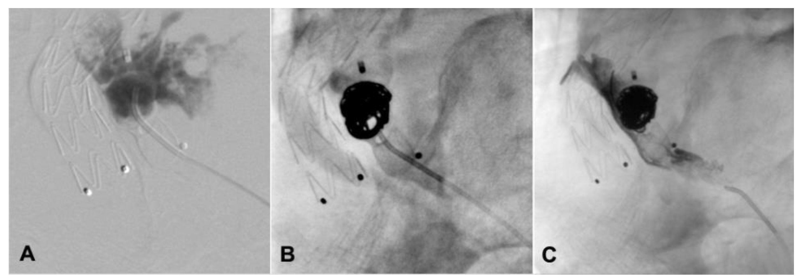 Jcm 13 02909 g002 Jcm 13 02909 g002