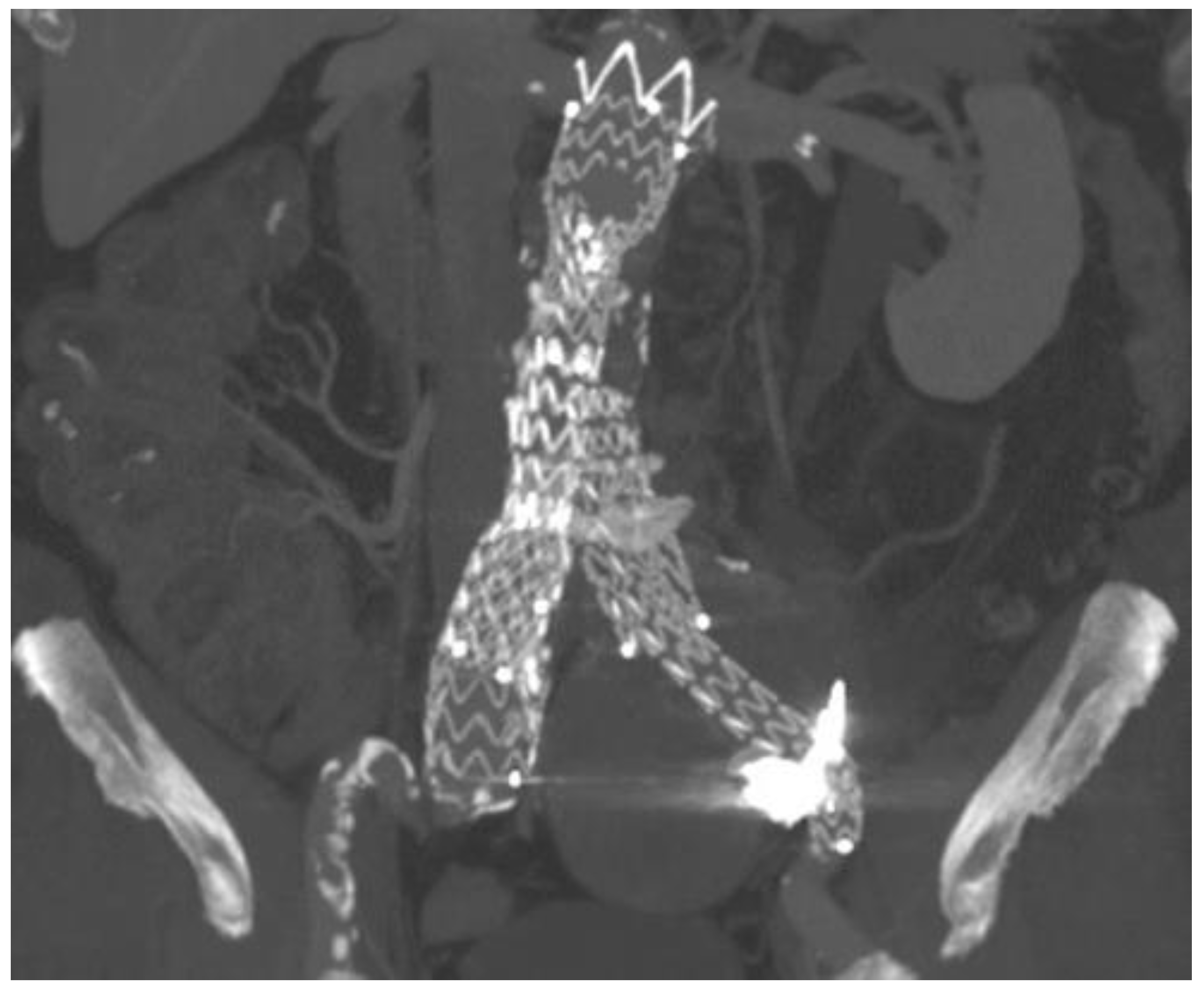 Jcm 13 02909 g003 Jcm 13 02909 g003