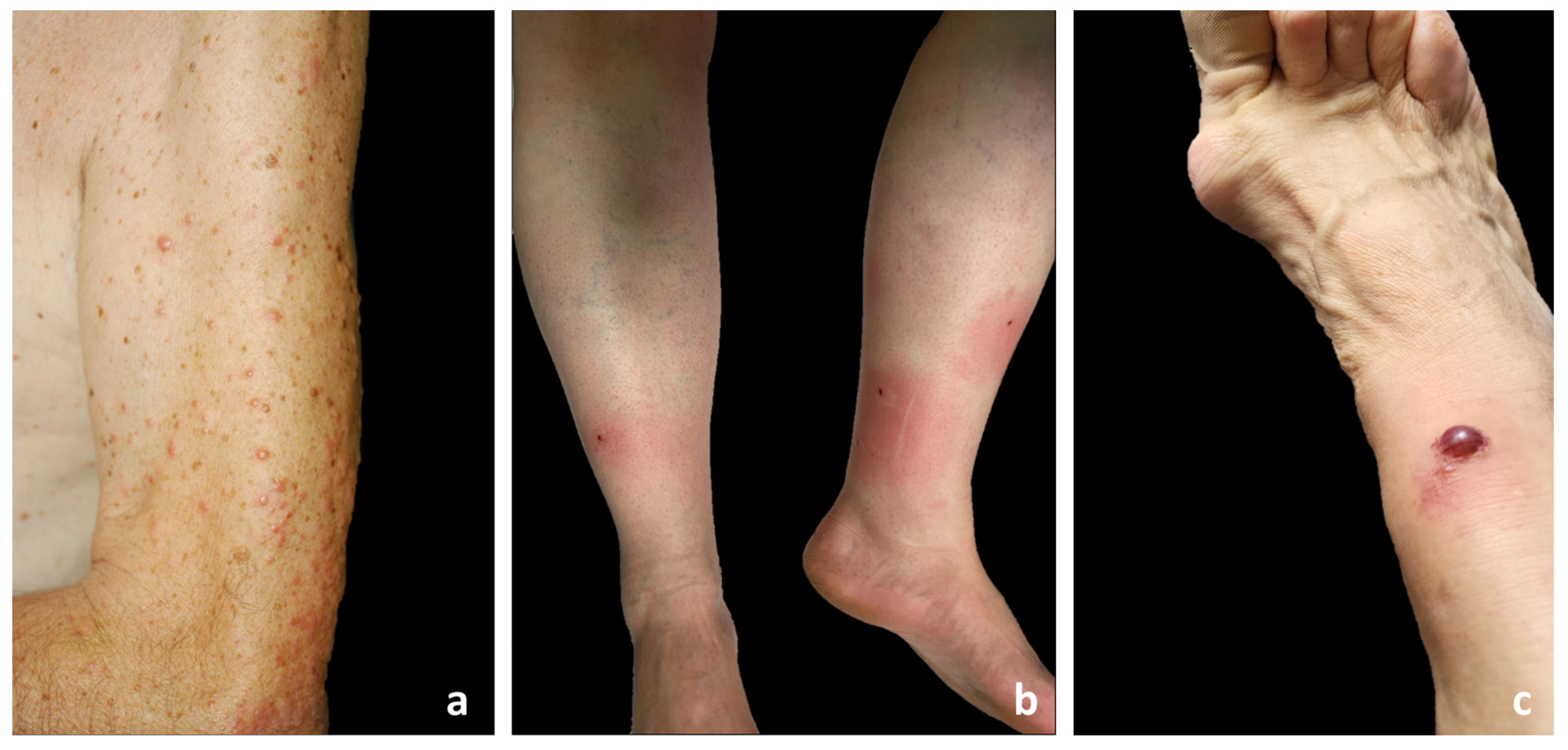 Jcm 13 02935 g001 Jcm 13 02935 g001