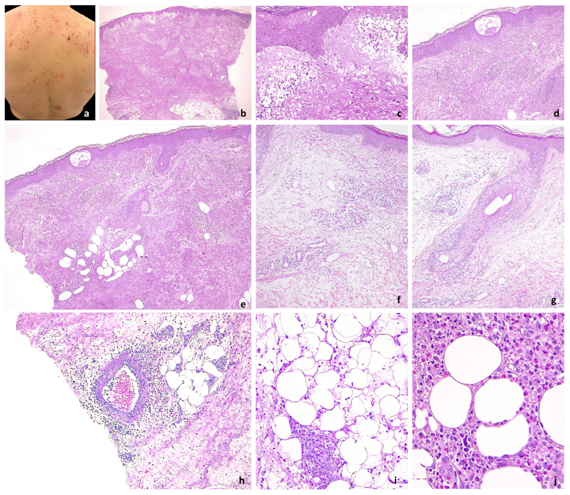 Jcm 13 02935 g002 Jcm 13 02935 g002