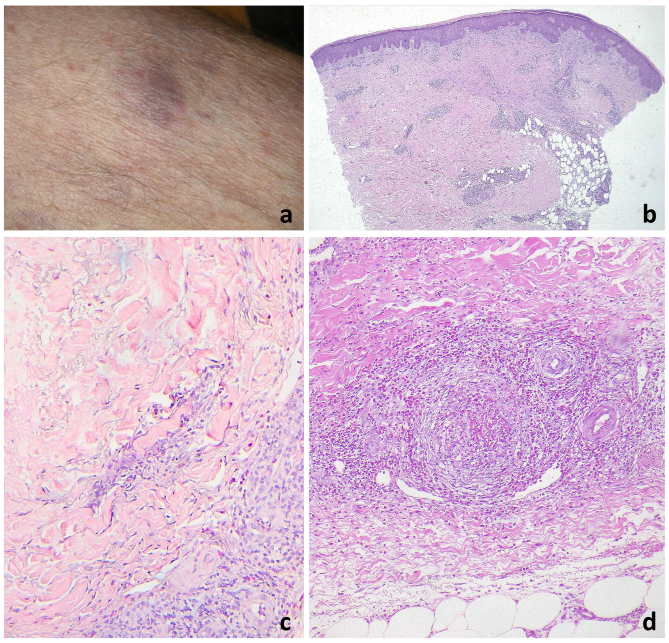 Jcm 13 02935 g004 Jcm 13 02935 g004