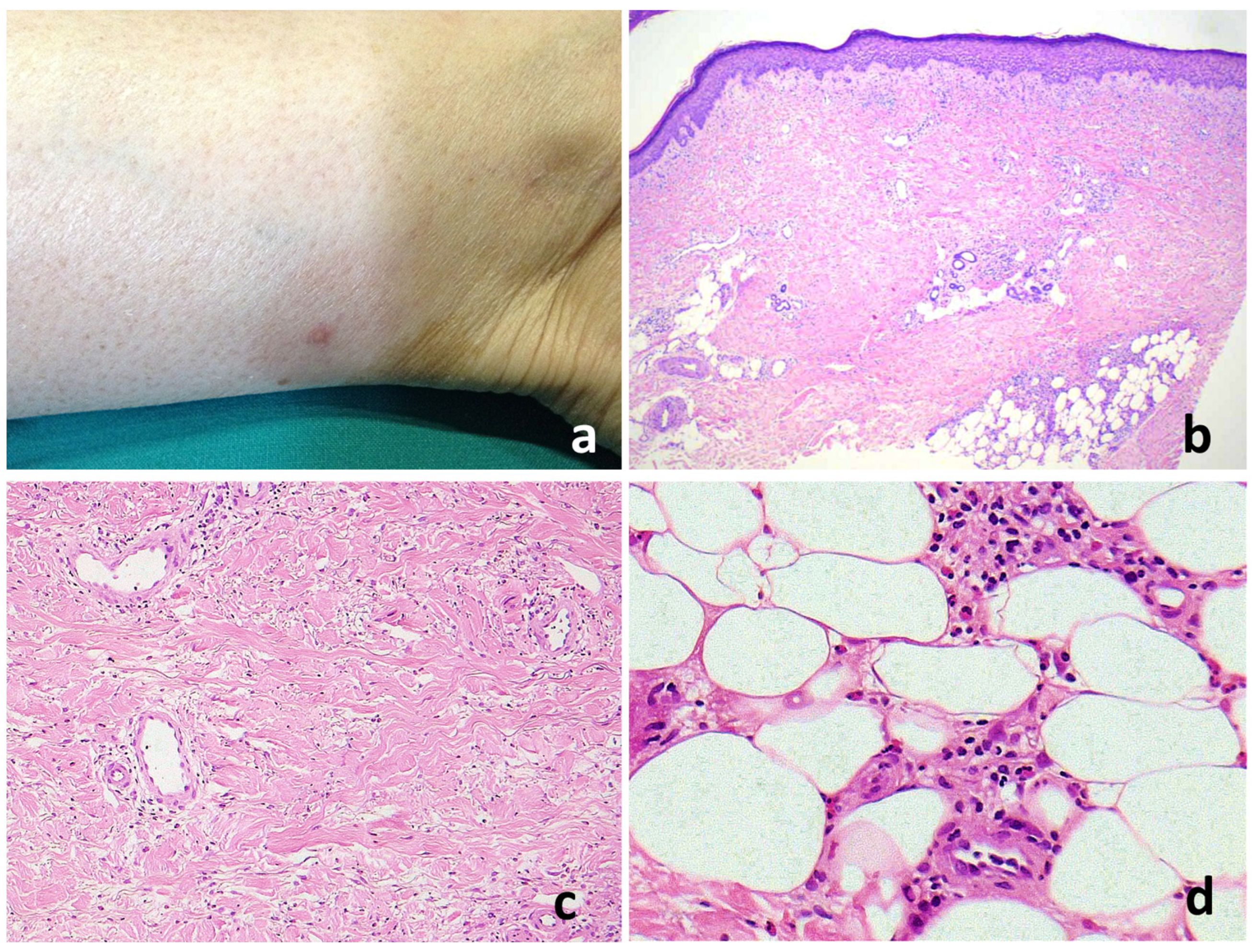 Jcm 13 02935 g005 Jcm 13 02935 g005