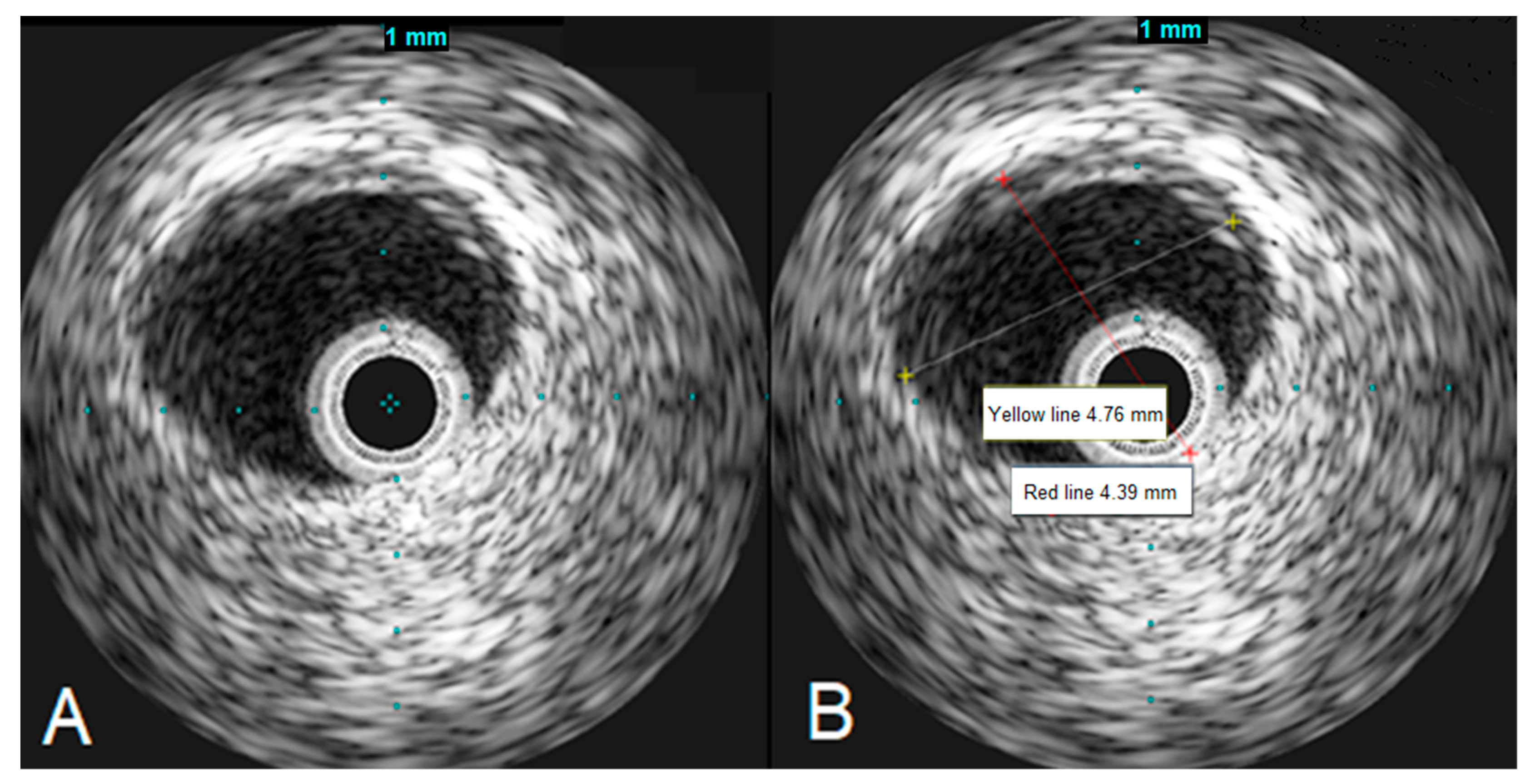 Jcm 13 03130 g004 Jcm 13 03130 g004
