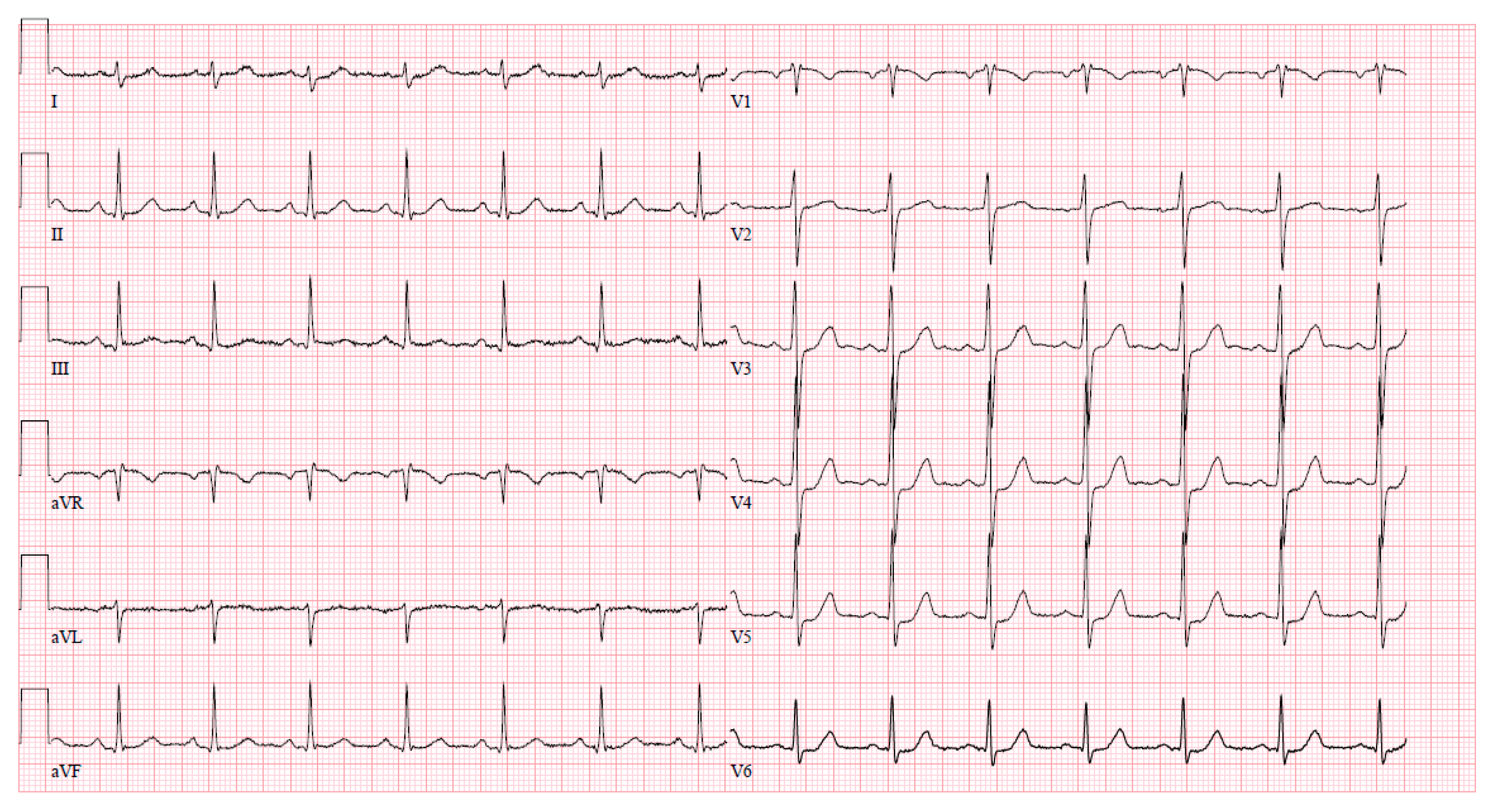 Jcm 13 03130 g005 Jcm 13 03130 g005