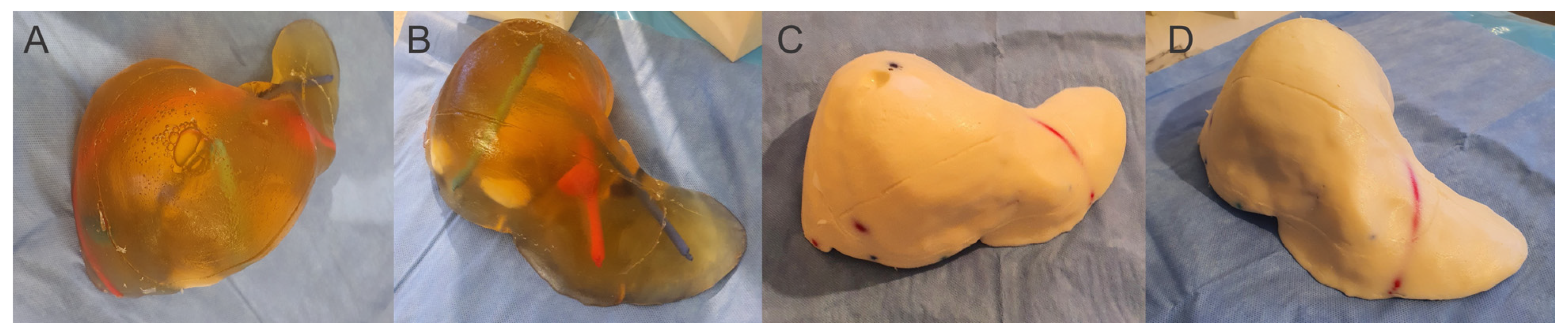 Jcm 13 03440 g004 Jcm 13 03440 g004