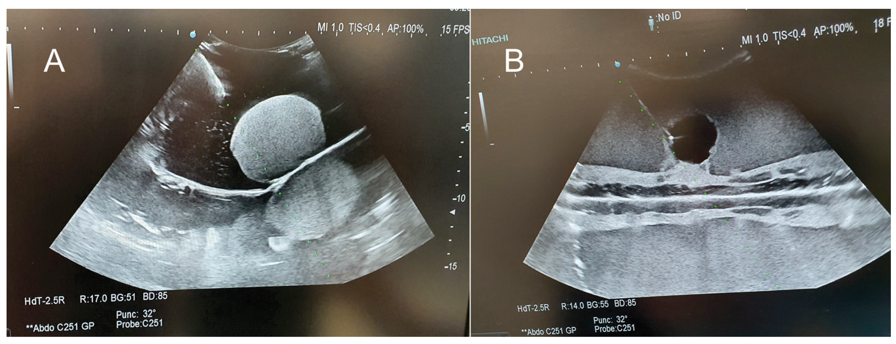 Jcm 13 03440 g005 Jcm 13 03440 g005