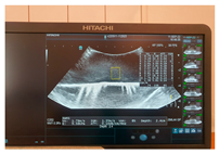 Jcm 13 03440 i016 Jcm 13 03440 i016