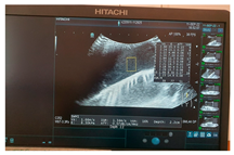 Jcm 13 03440 i017 Jcm 13 03440 i017