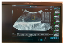 Jcm 13 03440 i018 Jcm 13 03440 i018