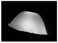 Jcm 13 03440 i022 Jcm 13 03440 i022