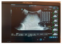 Jcm 13 03440 i031 Jcm 13 03440 i031