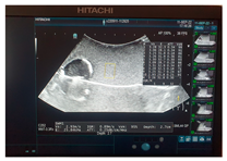 Jcm 13 03440 i033 Jcm 13 03440 i033