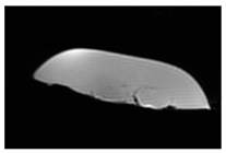 Jcm 13 03440 i038 Jcm 13 03440 i038