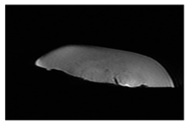 Jcm 13 03440 i041 Jcm 13 03440 i041